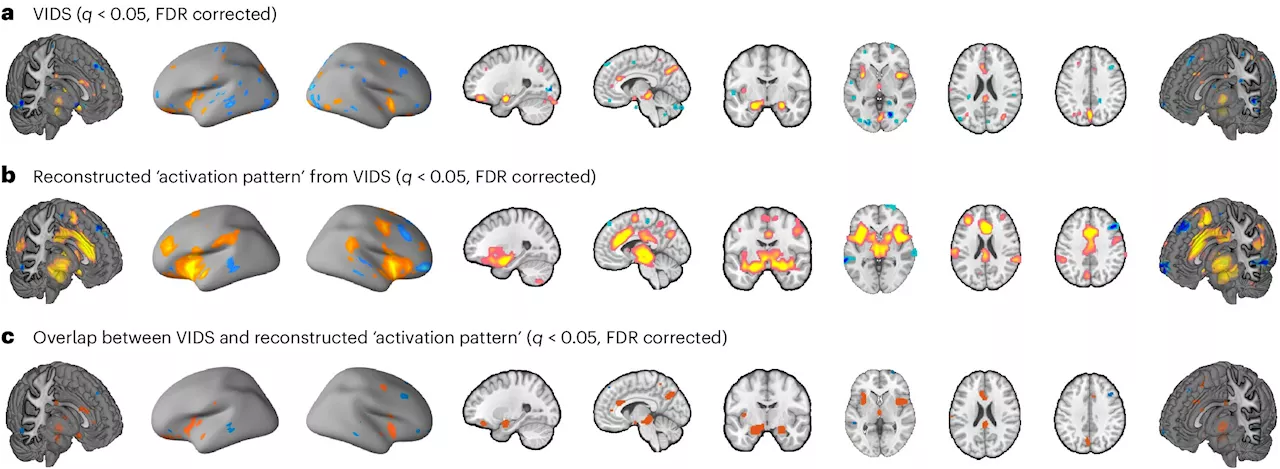 The neural signature of subjective disgust could apply to both sensory and socio-moral experiences