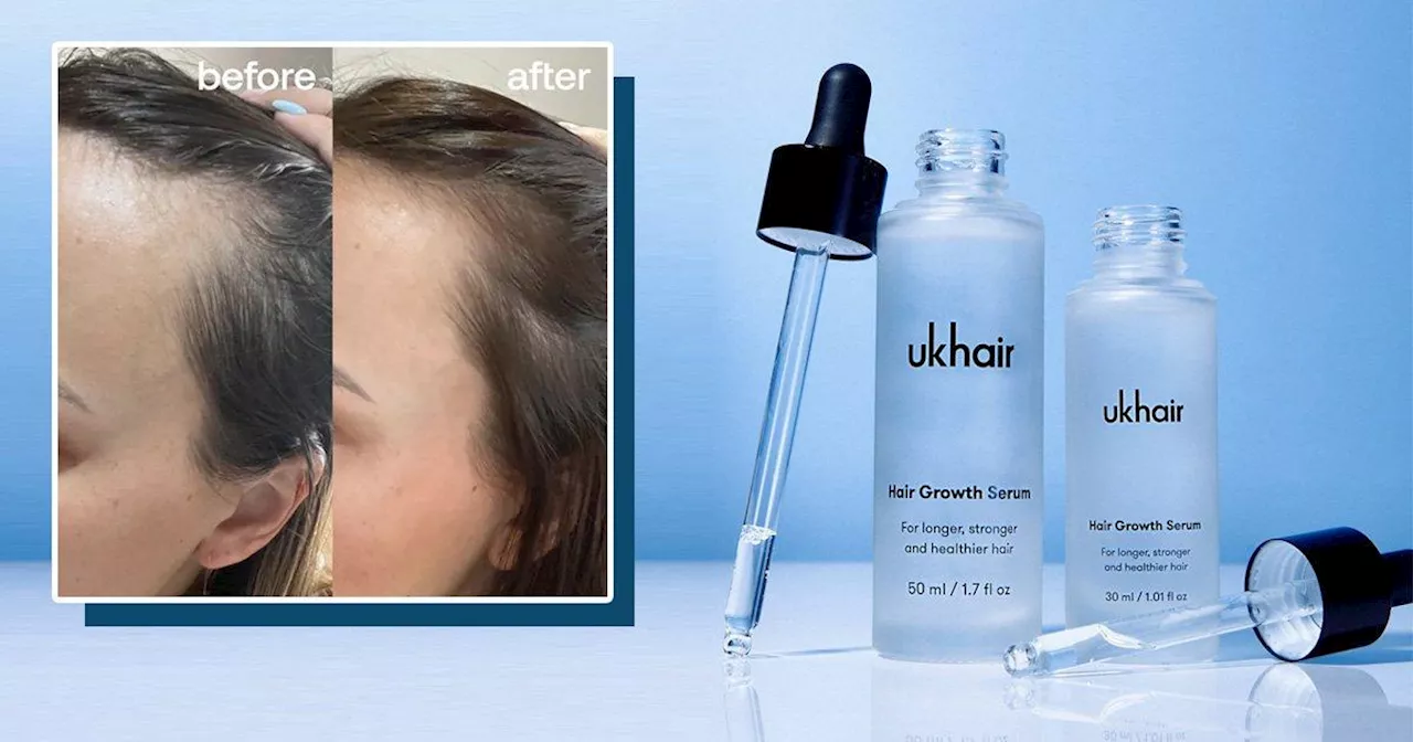 This hair growth serum reduces loss by 95% and growth by 85% in months