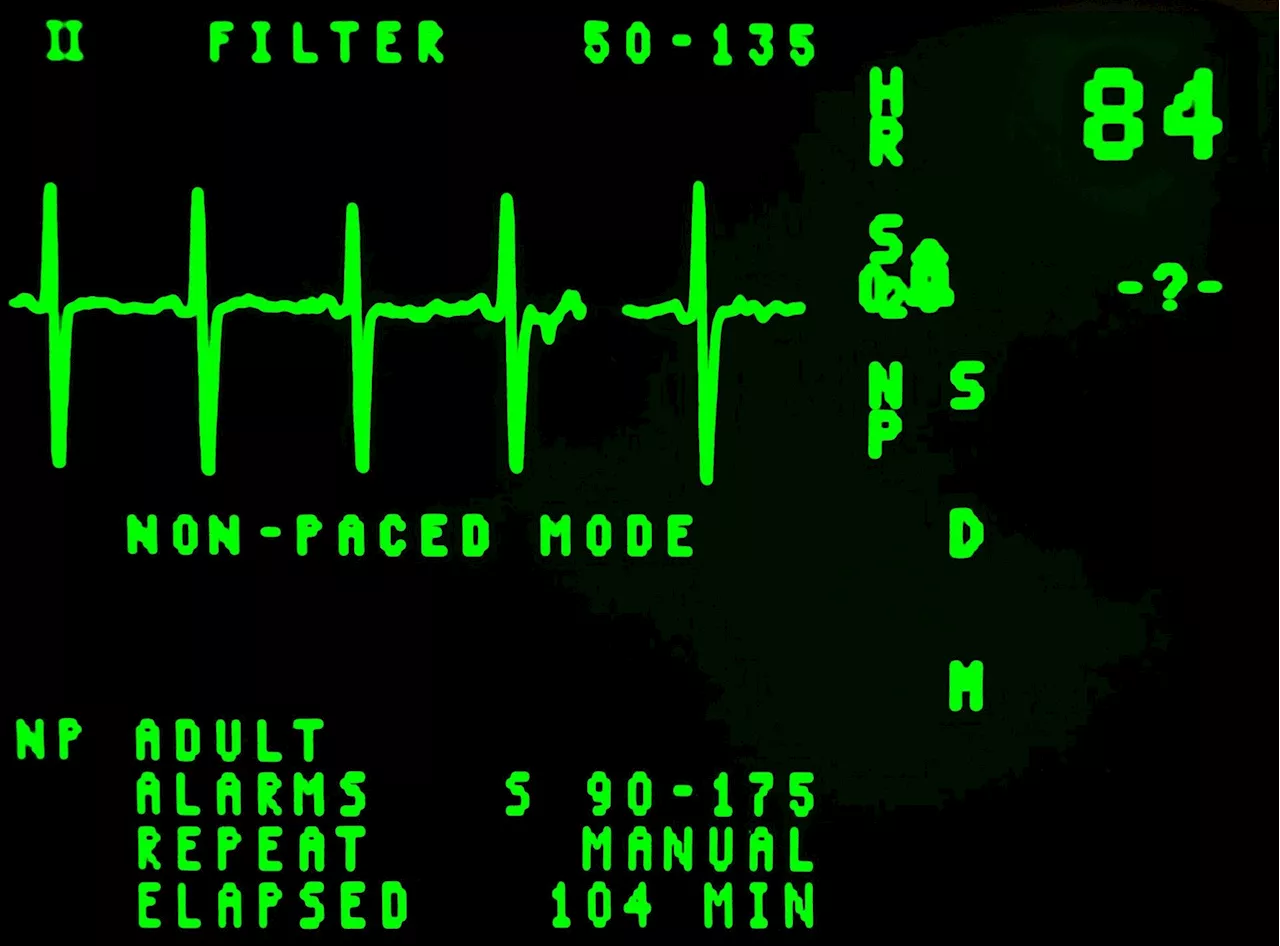 Modular communicative leadless ICD found to be safe and exceeds performance expectations