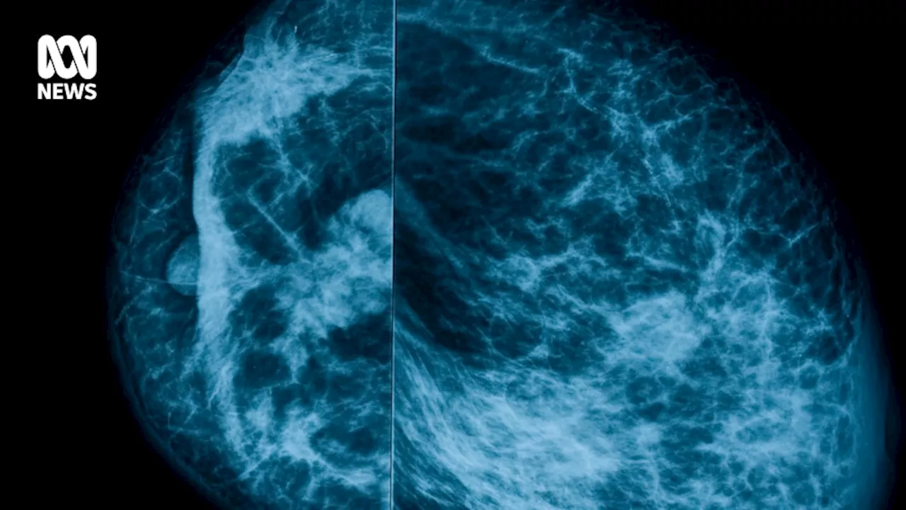 Breast cancer is becoming more common among under-50s — and free screening is a secret