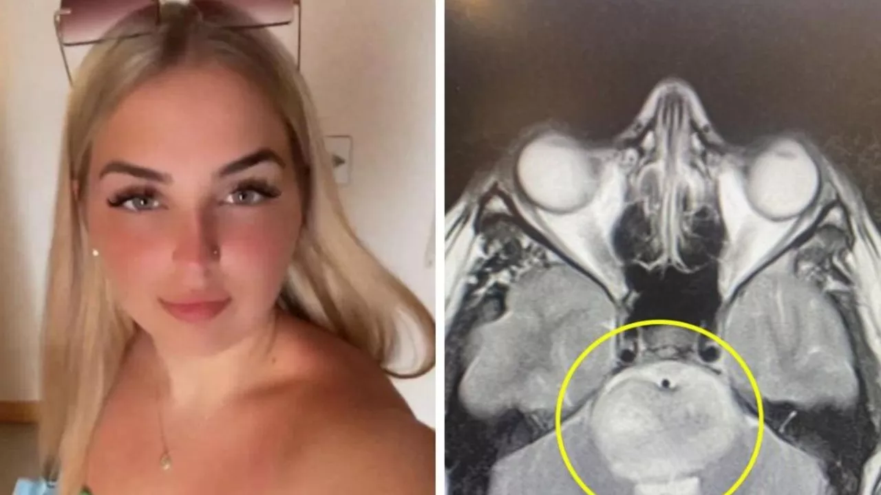 Teen’s ‘hangover’ reveals shocking diagnosis