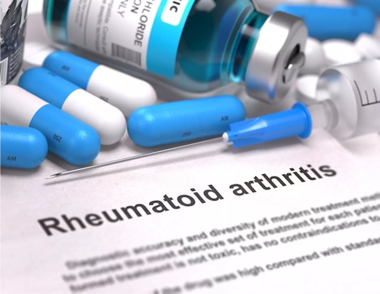 Researchers unveil unique autoantibody profiles in rheumatoid arthritis patients