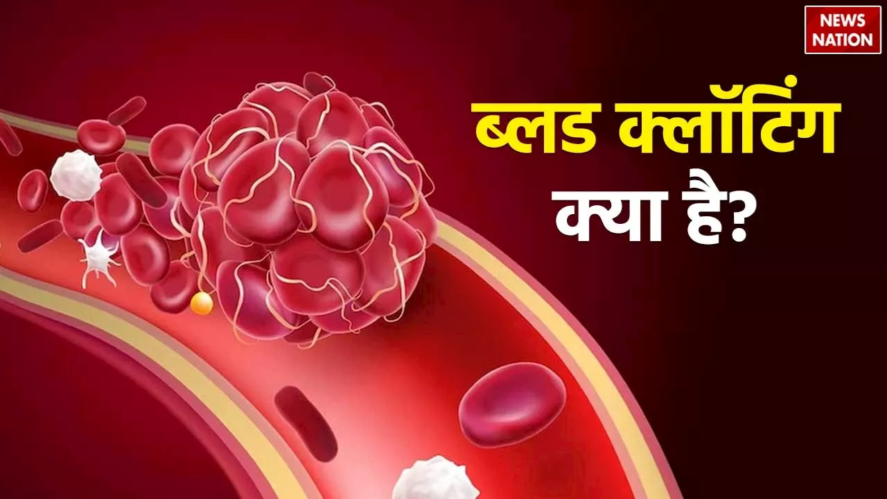 Covishield Vaccine: जानलेवा!! कोविशील्ड वैक्सीन लगवाने वालों को हो सकती है ब्लड क्लॉटिंग, जानें क्या है बीमारी