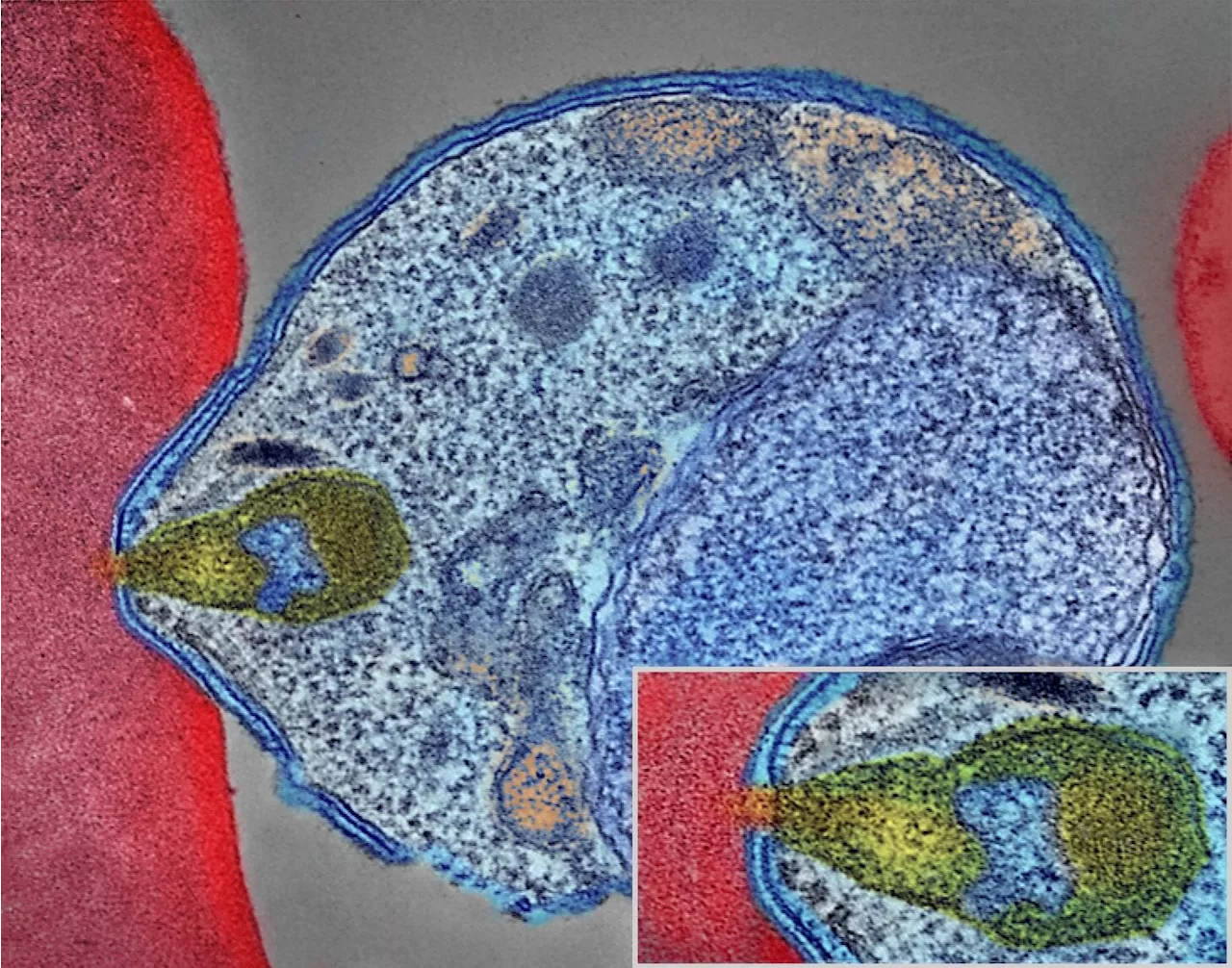 Deeper understanding of malaria parasite sexual development unlocks opportunities to block disease spread