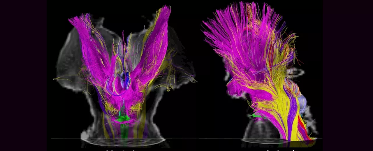 On MRI Scans, Scientists Find What Could Explain Altered States of Consciousness