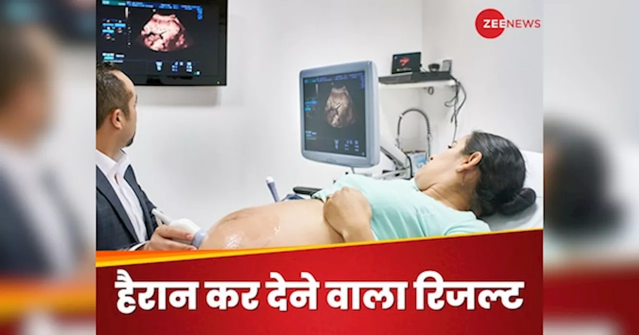 अल्ट्रासाउंड कराने गई टिकटॉक Video बनाने वाली प्रेग्नेंट महिला, डॉक्टर ने बताई हैरान कर देने वाली बात