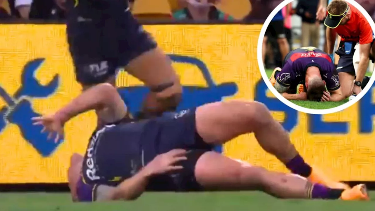 Cameron Munster facing surgery decision after Melbourne Storm and Qld Maroons star suffers awful groin injury