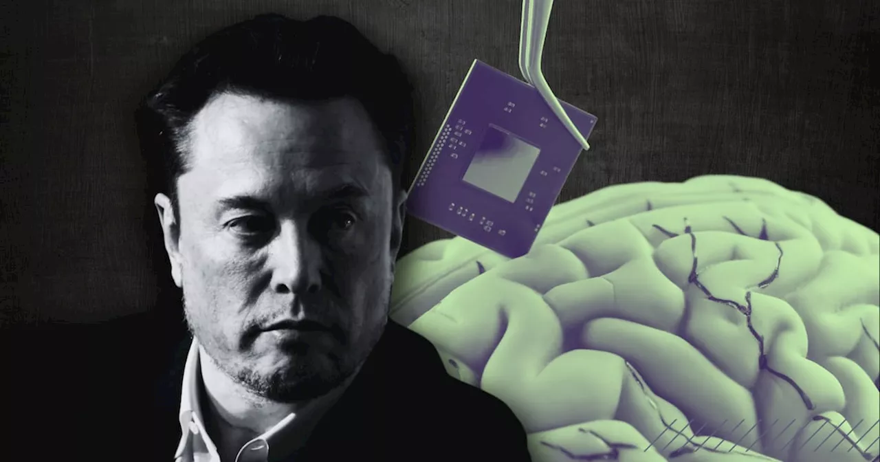 Neuralink, de Elon Musk, busca a un segundo candidato para probar su chip cerebral