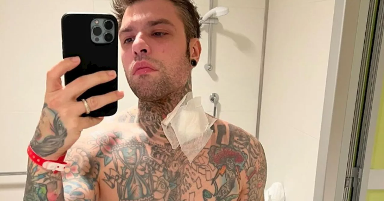 Fedez, la nota dello staff: &#034;Condizioni di salute più gravi di quanto immaginato&#034;