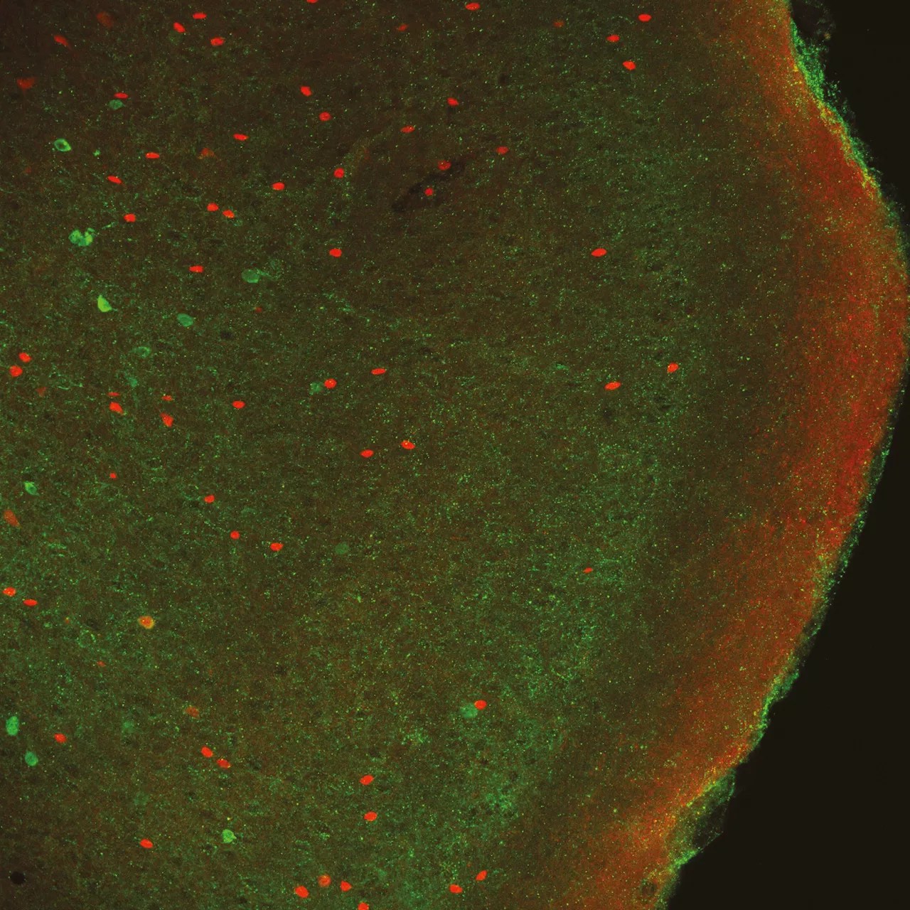 Happy or angry: Researchers discover brain network that recognizes emotions