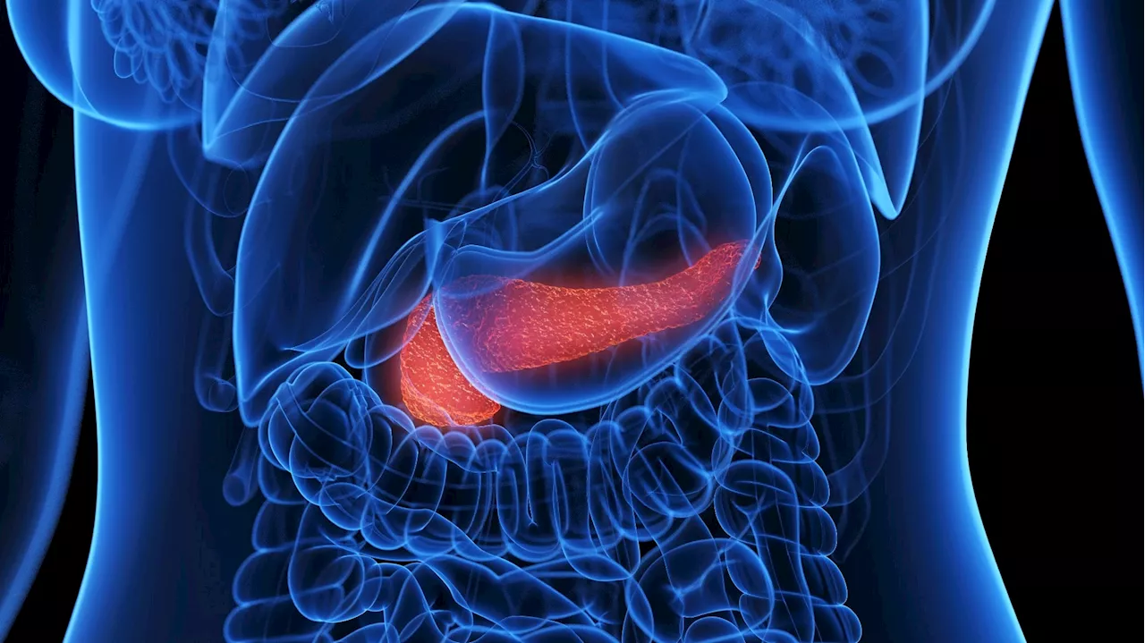 New study identifies key protein biomarkers for early detection of pancreatic cancer