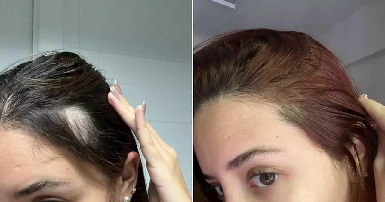 New hair serum has 'doubled the amount of hair' for shoppers in 5 weeks