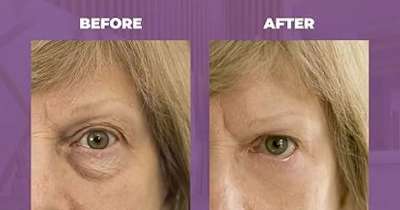 Amazon shoppers 'look 25 again' after trying £18 eye cream