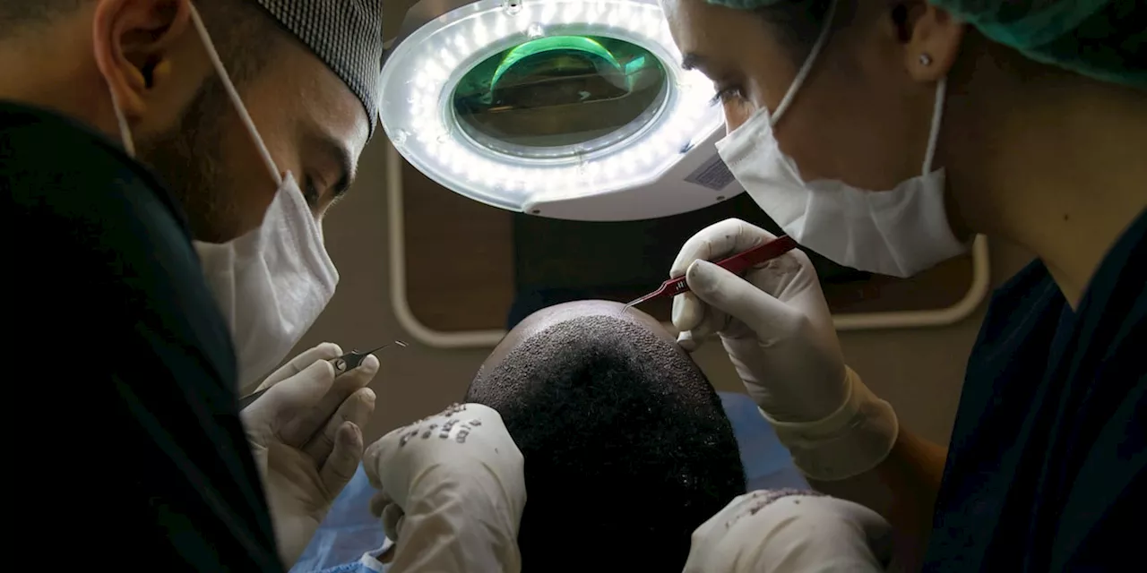 Was Sie bei Haartransplantation in der Türkei überdenken sollten