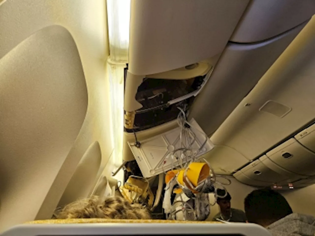 Injured passengers on turbulence-hit Singapore Airlines likely eligible for compensation