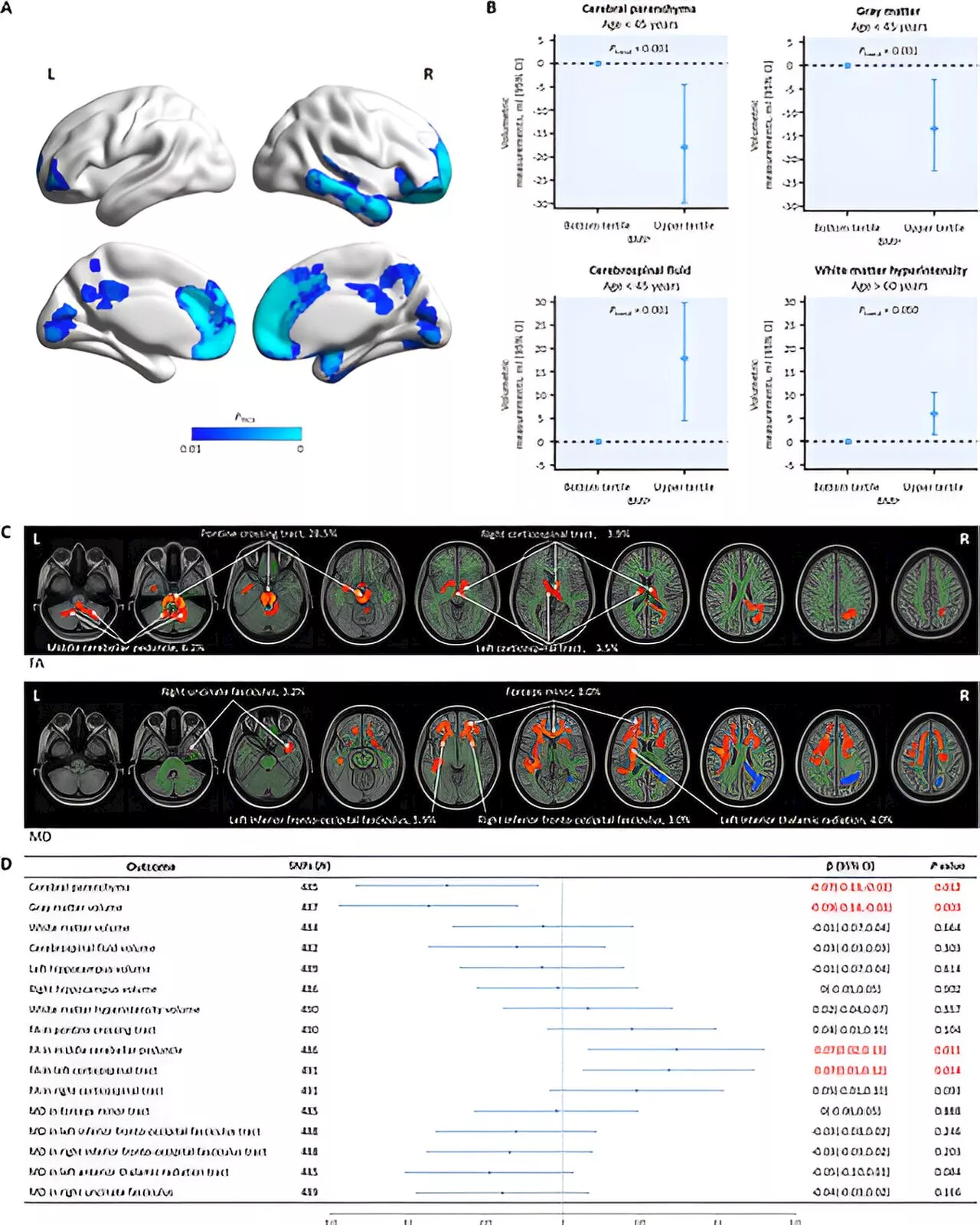 High BMI linked to reduced brain volume and increased white matter lesions