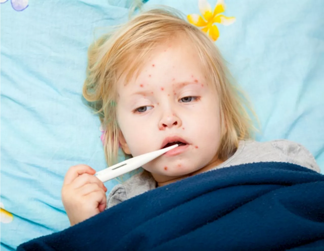 4 ways vaccine skeptics mislead you on measles and more