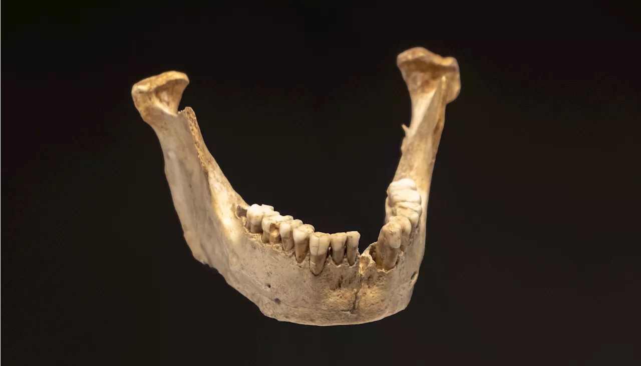 Ancient Neanderthal and Paleolithic Teeth Show Signs of Childhood Stress