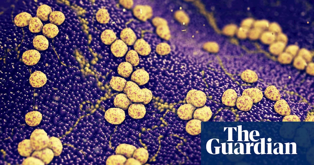 Huge number of deaths linked to superbugs can be avoided, say experts