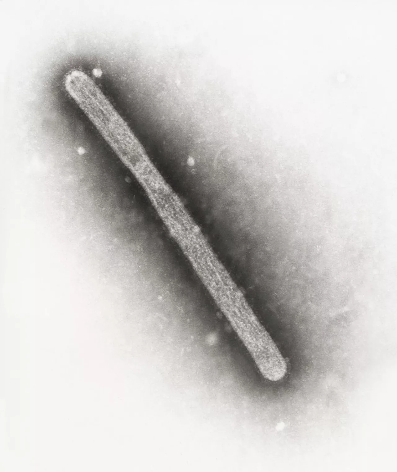 US reports 2nd human case of bird flu tied to dairy cow outbreak