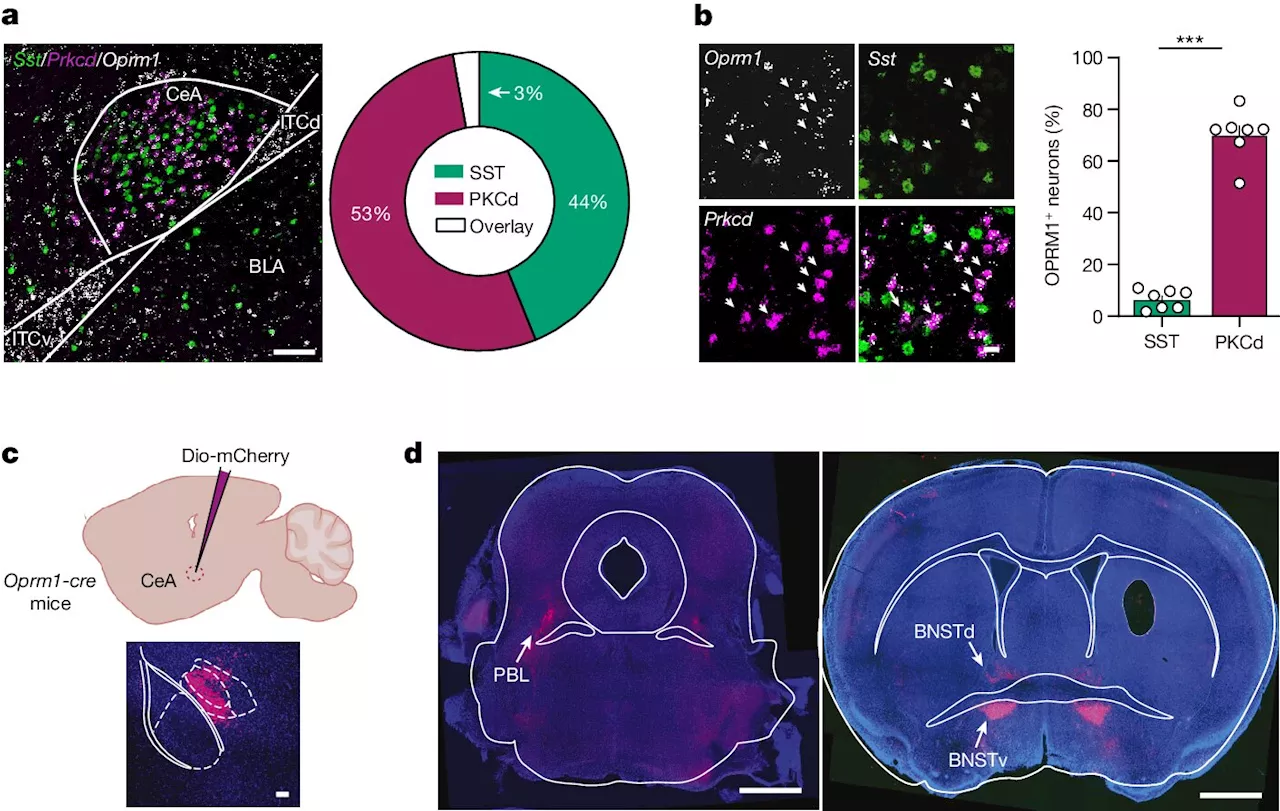 Study shows two neural pathways involved in fentanyl addiction