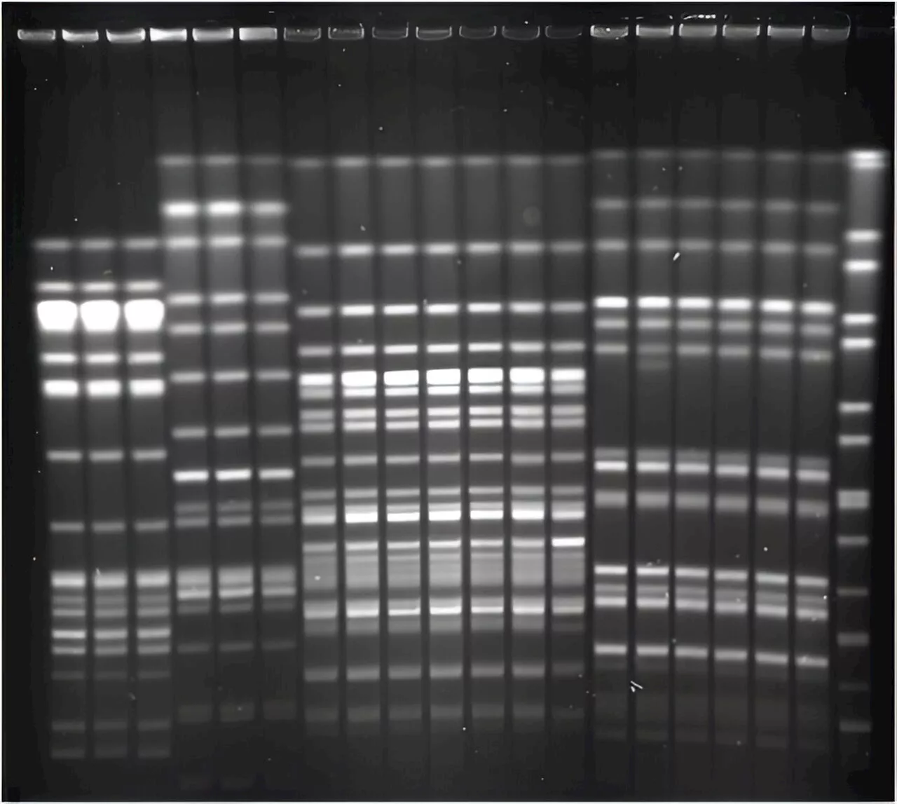 Researchers develop tool for detecting foodborne pathogen that causes severe symptoms in children