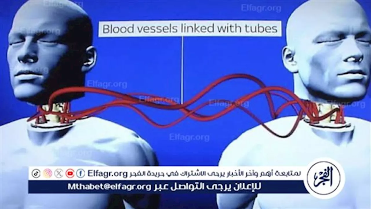 نظام زراعة الرأس: الابتكار الطبي الذي يفتح آفاقًا جديدة للعلاج