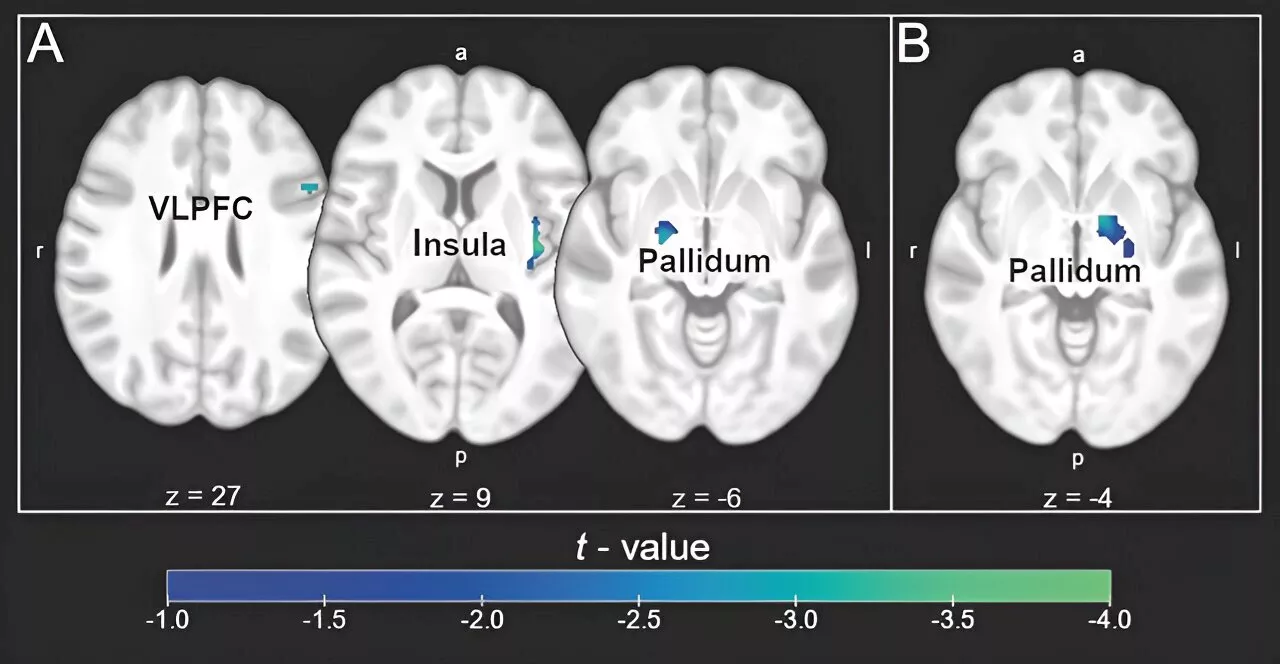 Imaginary placebo intake study investigates neural response for regulating disgust