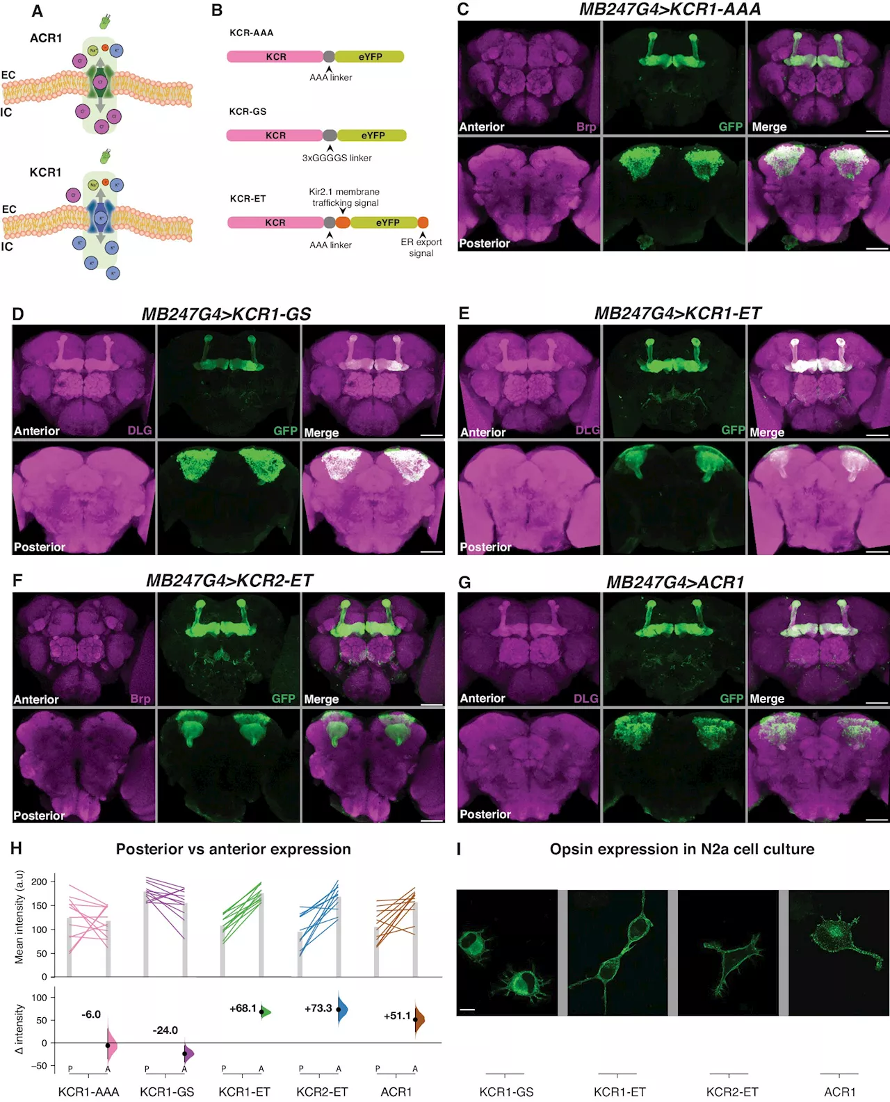 Researchers develop new light-controlled 'off switch' for brain cells