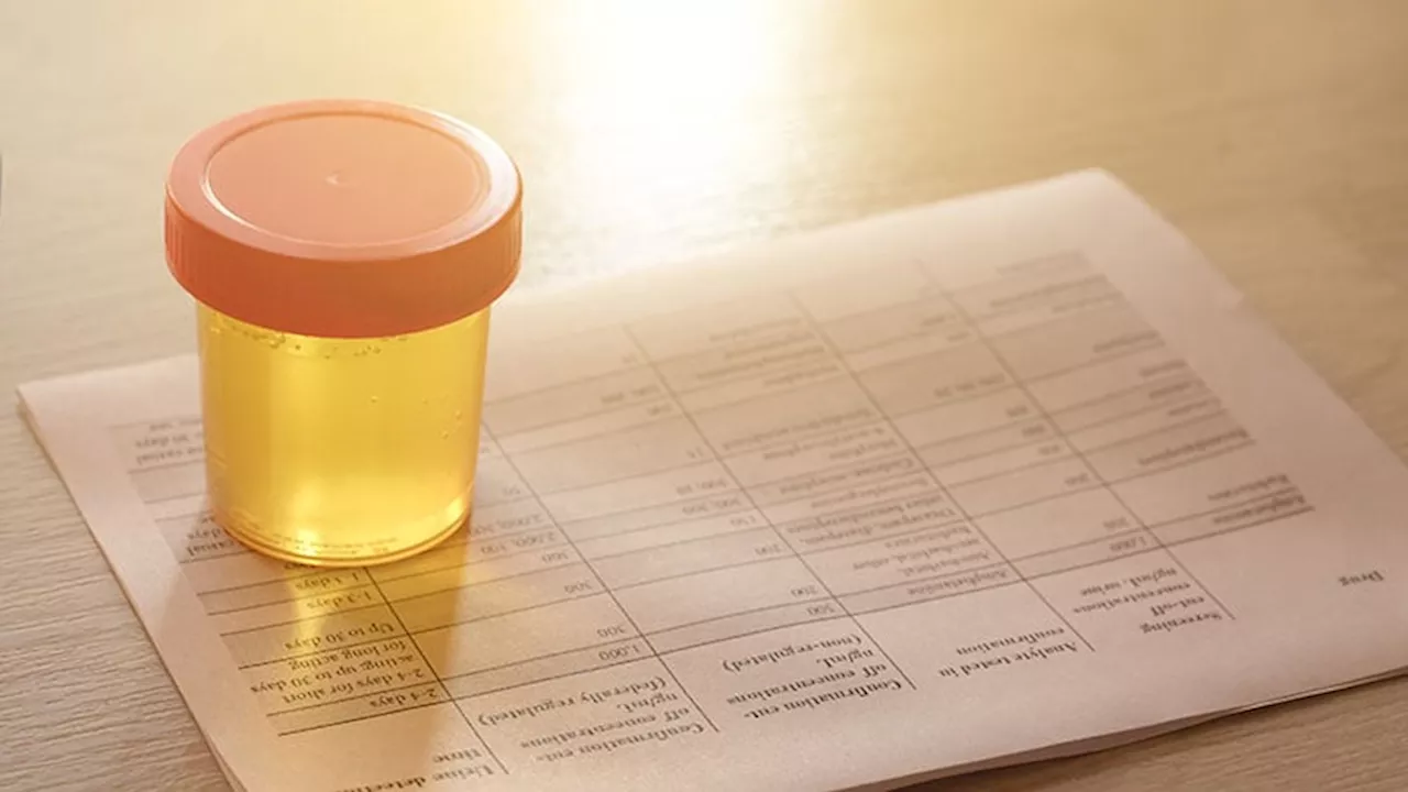 Urine Test Could Prevent Unnecessary Prostate Biopsies