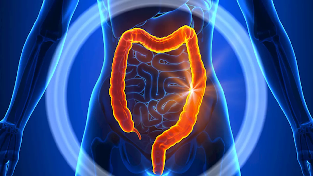 Tumore al colon retto verrà sconfitto dai batteri intestinali?