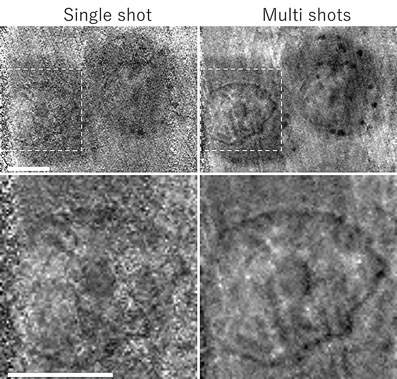 Observing mammalian cells with superfast soft X-rays