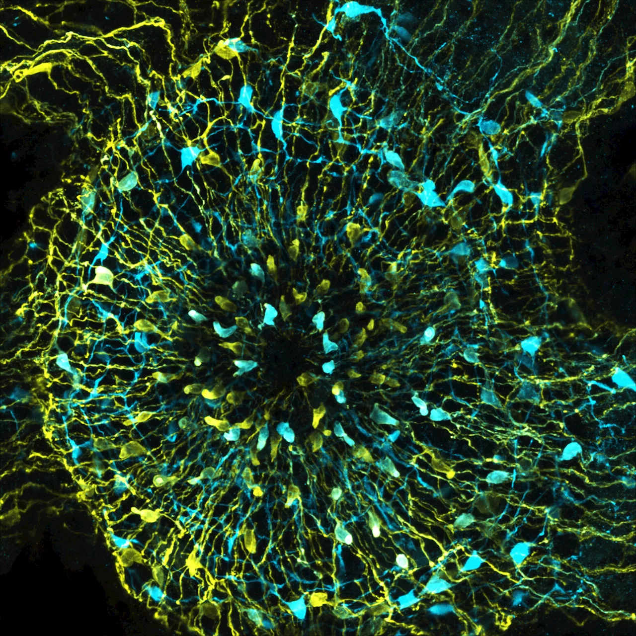 Researchers reveal evolutionary origins of appetite by studying simple nervous system of Hydra