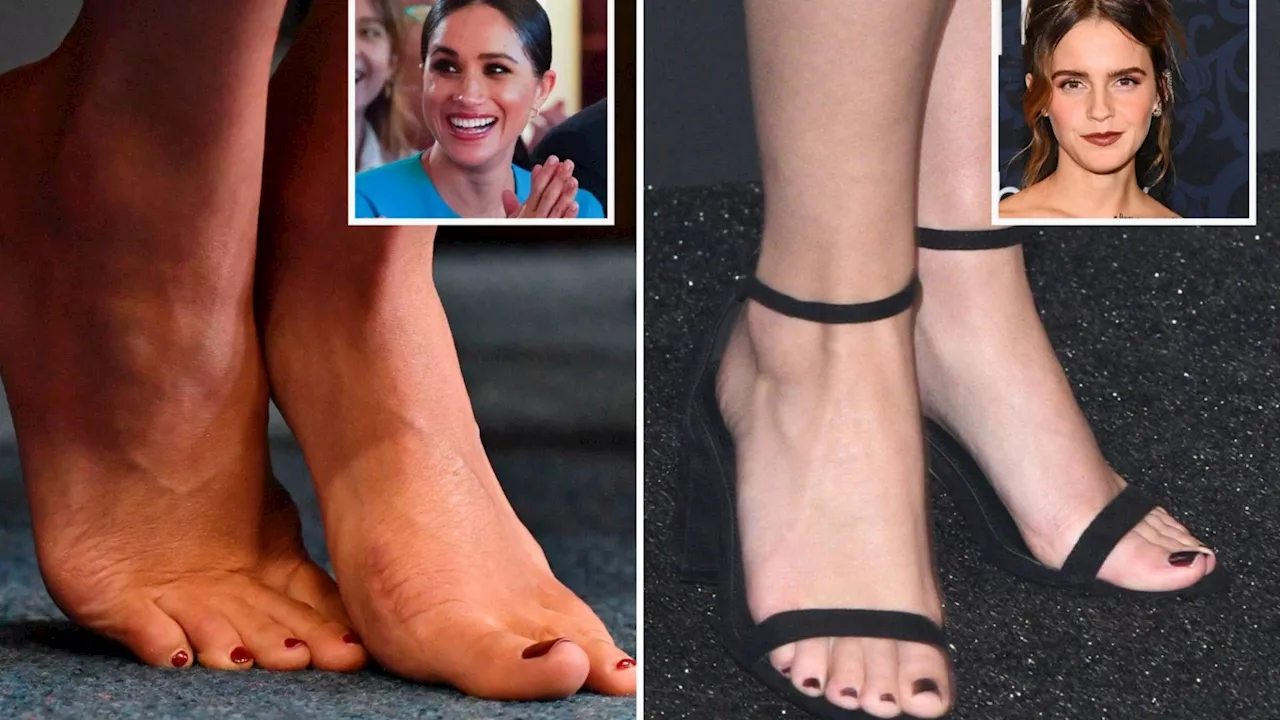 Who has the most beautiful feet in the world? According to the golden ratio...