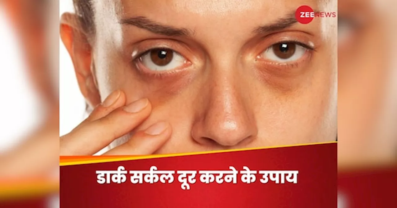 Dark Circles कहीं छीन लें खूबसूरत दिखने की चाहत, किचन की इन 5 चीजों से दूर हो कालापन