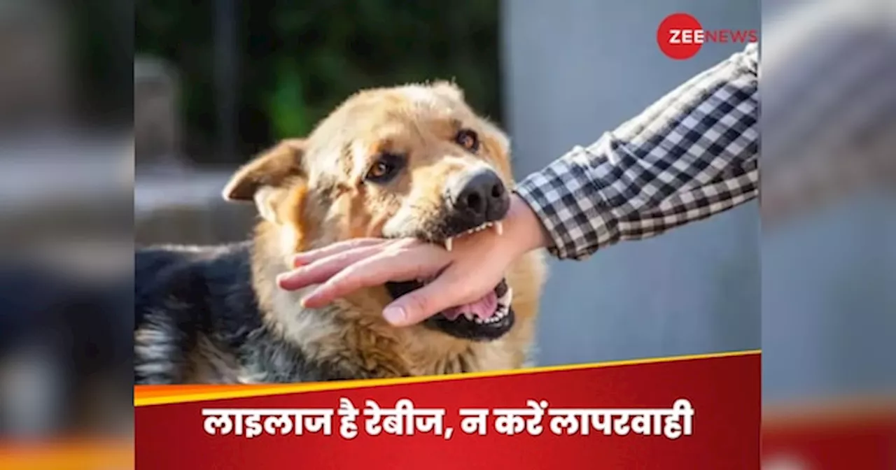 Rabies: कुत्ता- बिल्ली या बंदर काटे तो कितने बाद तक लगवा सकते हैं इंजेक्शन? डॉक्टर से जानें रेबीज से निपटने के टिप्स