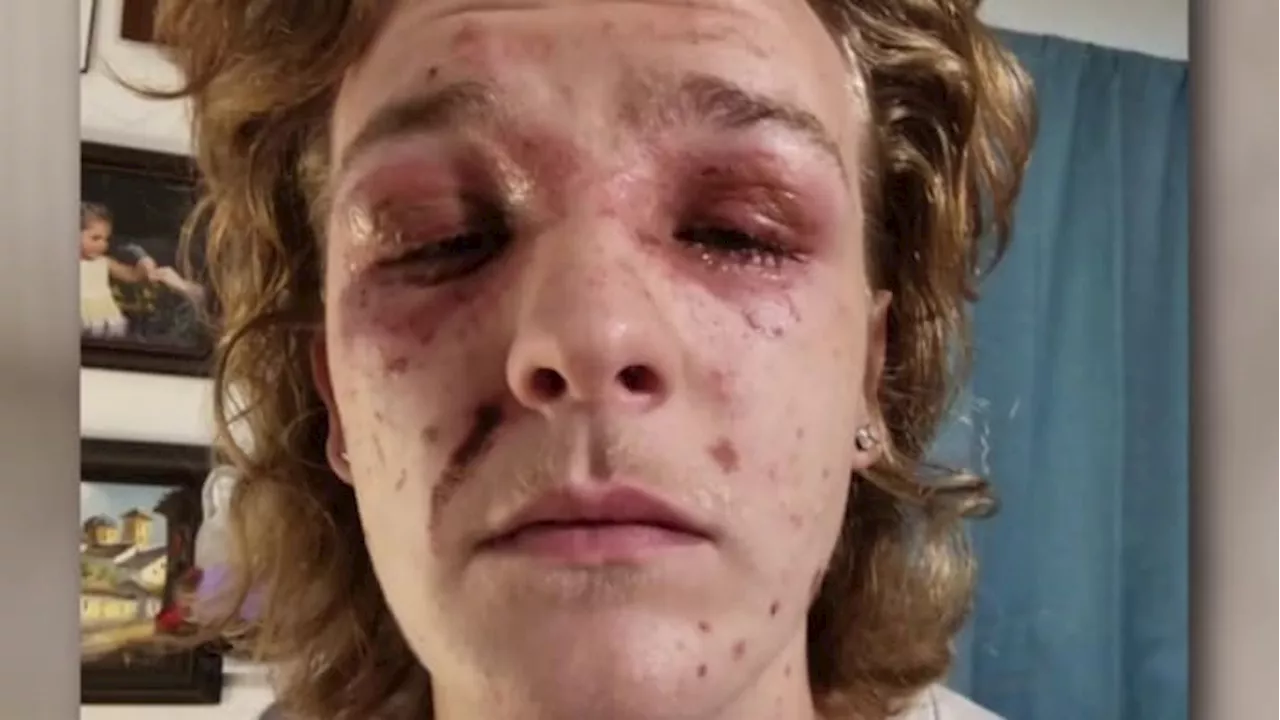 ‘Not everyone is your friend’: Friendswood teen accused of throwing chemical substance on teen who could lose vision