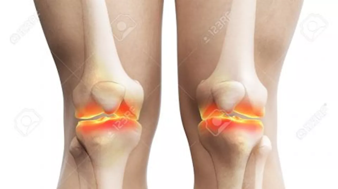 Terapi Stem Cell Obati Osteoarthritis pada Lansia