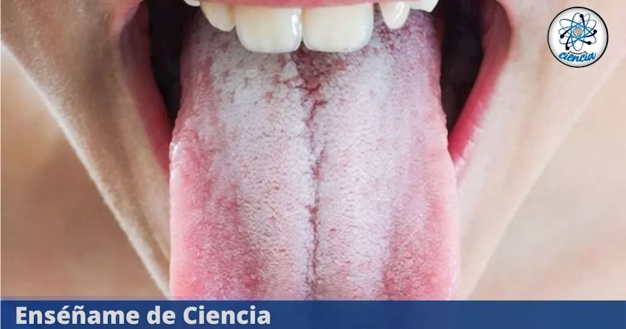 ¿Qué es la sustancia blanca que se forma en la lengua y por qué aparece?