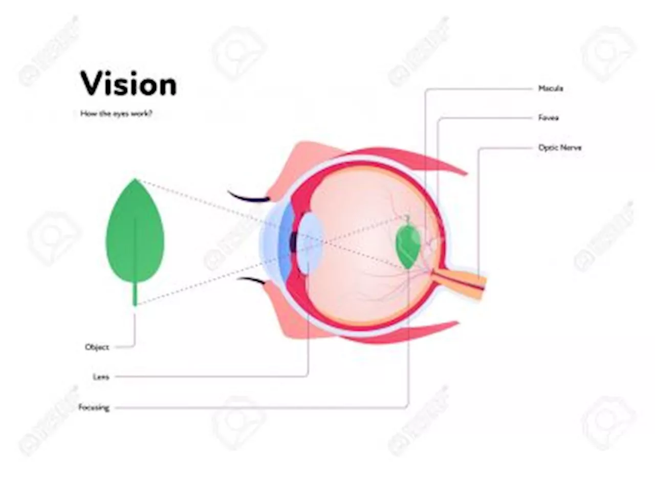 Ketahui Ablasio Retina, Retina Robek yang Dapat Sebabkan Kebutaan