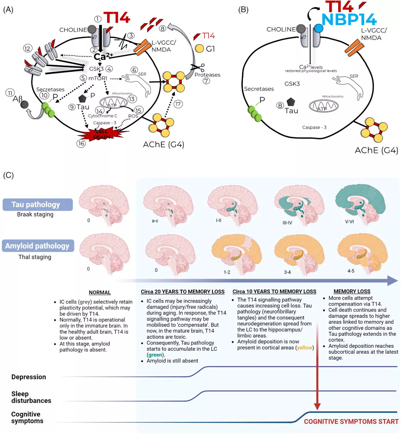 Researchers examine evidence for a novel neuronal mechanism driving Alzheimer's disease