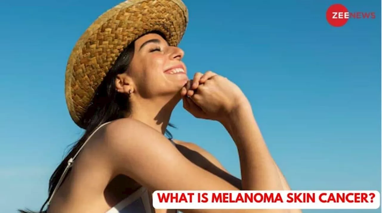 What Is Melanoma Skin Cancer? Symptoms And Safety Tips To Keep In Mind