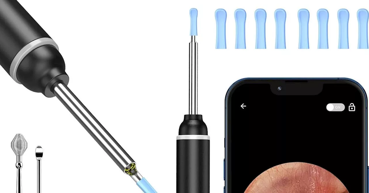 Ear wax remover with camera that connects to your phone now just £14 on Amazon