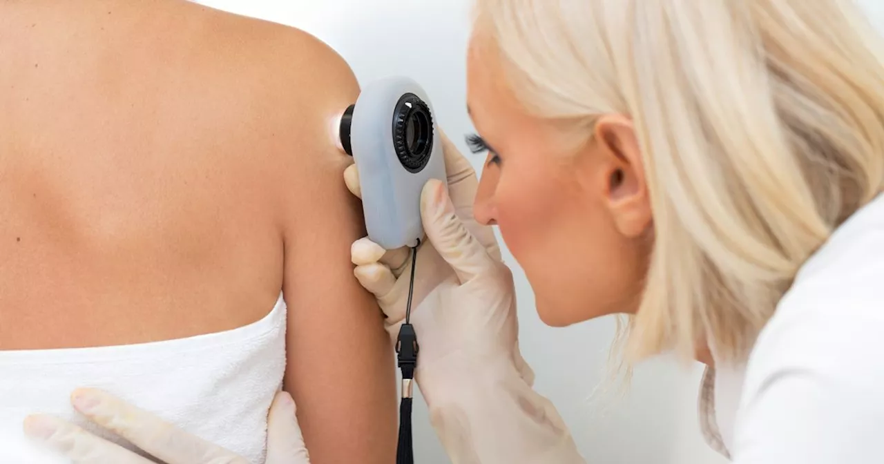 Red flags to look out for that could be signs of skin cancer