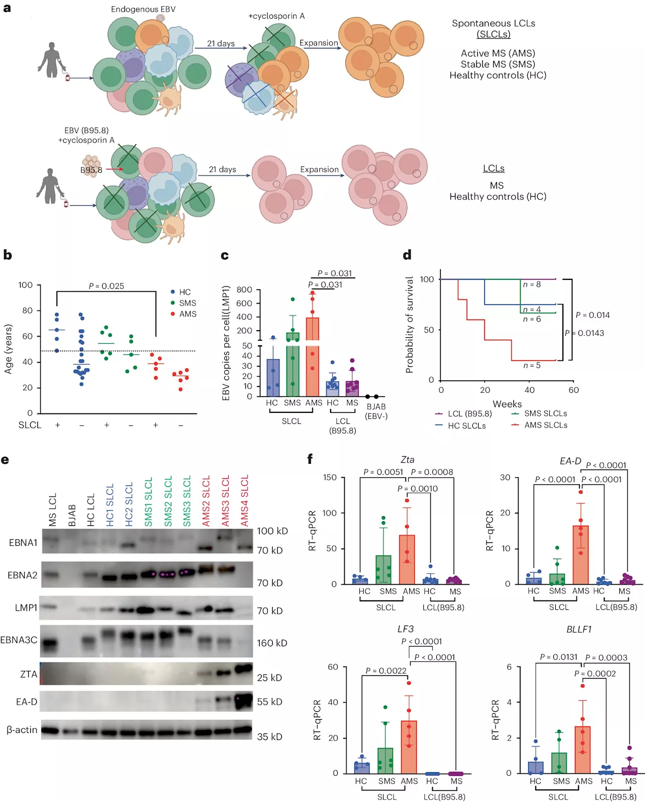 Research identifies mechanisms for selective multiple sclerosis treatment strategy
