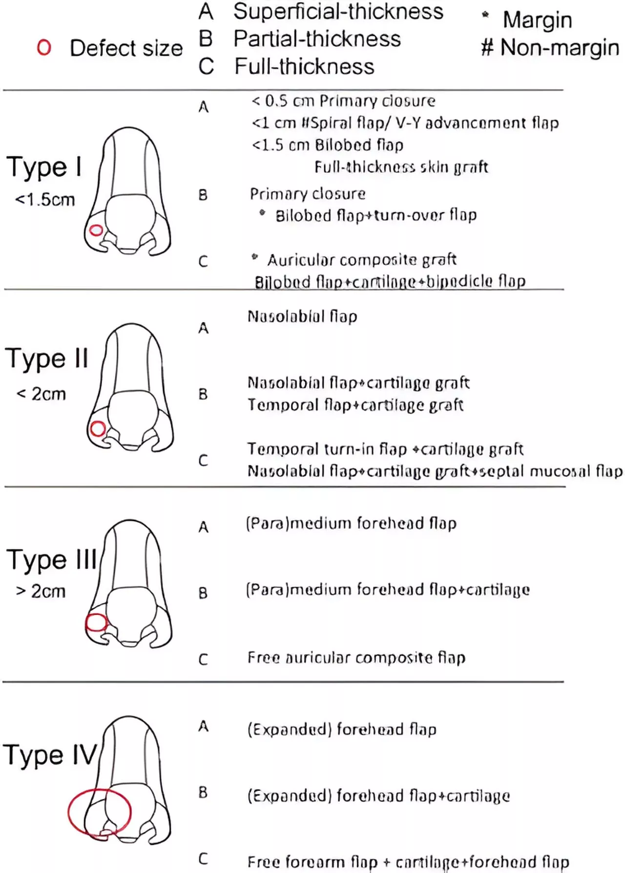 Researchers propose surgical algorithm for nasal alar defects in Asian patients