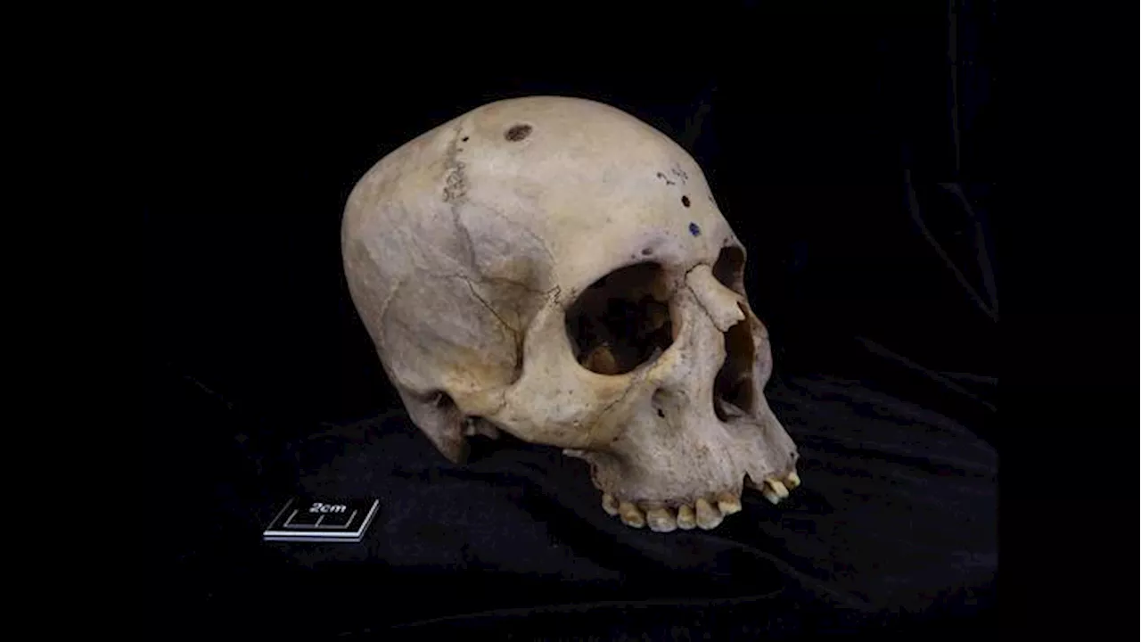 Skull Incisions Show Ancient Egyptians’ Interest in Medicine