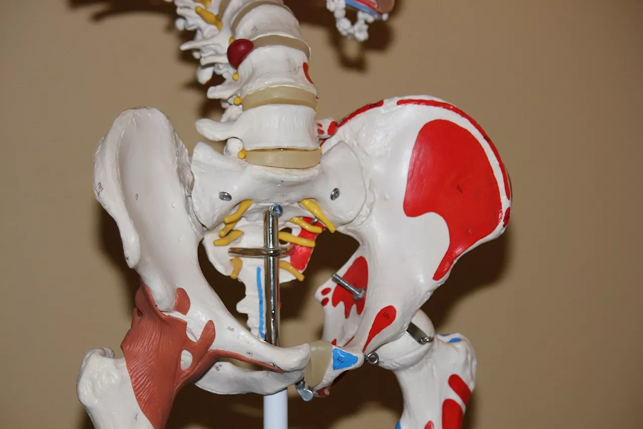 A protein-based risk score for hip-fracture using an aptamer-based proteomic platform