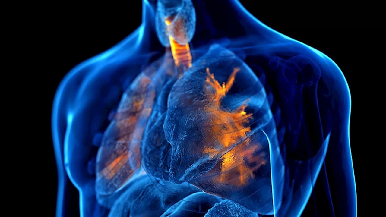 Understudied Patients With COPD Benefit From Bronchoscopic Lung Reduction