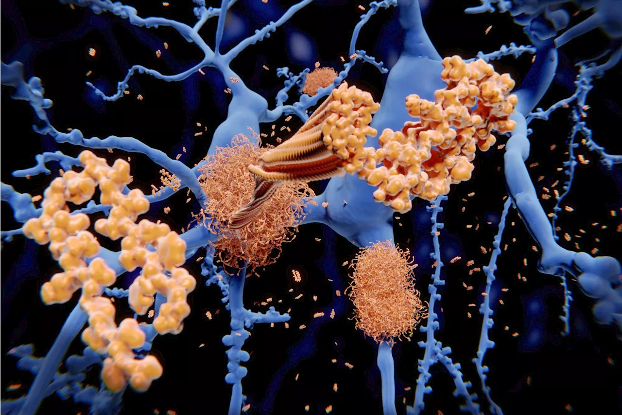 Study finds Plexin-B1 could be key to Alzheimer’s treatment, enhancing glial cell response